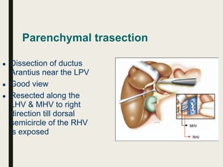 Parenchymal trasection
● Dissection of ductus
Arantius near the LPV
● Good view
● Resected along the
LHV & MHV to right
direction till dorsal
semicircle of the RHV
is exposed
 