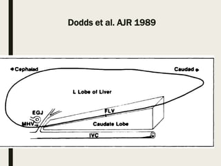 Dodds et al. AJR 1989
 