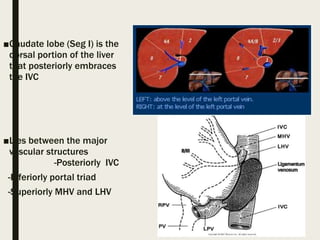 ■Caudate lobe (Seg I) is the
dorsal portion of the liver
that posteriorly embraces
the IVC
■Lies between the major
vascular structures
-Posteriorly IVC
-Inferiorly portal triad
-Superiorly MHV and LHV
 