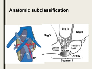 Anatomic subclassification
 