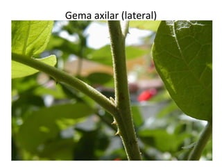 Gema axilar (lateral)

 