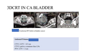 3DCRT IN CA BLADDER
 