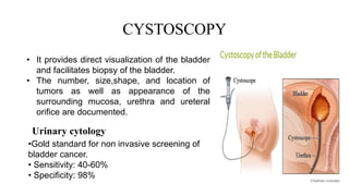 CYSTOSCOPY
• It provides direct visualization of the bladder
and facilitates biopsy of the bladder.
• The number, size,shape, and location of
tumors as well as appearance of the
surrounding mucosa, urethra and ureteral
orifice are documented.
Urinary cytology
•Gold standard for non invasive screening of
bladder cancer.
• Sensitivity: 40-60%
• Specificity: 98%
 