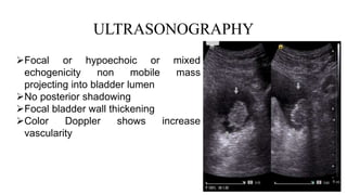 ULTRASONOGRAPHY
Focal or hypoechoic or mixed
echogenicity non mobile mass
projecting into bladder lumen
No posterior shadowing
Focal bladder wall thickening
Color Doppler shows increase
vascularity
 