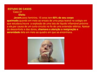 ESTUDO DE CASOS 
Caso 21 
Efeito 
Jovem,sexo feminino, 15 anos tem 60% de seu corpo 
queimado,quando em meio ao ensaio de uma peça teatral no colégio em 
que estudava,houve a explosão de uma lata de líquido inflamável próximo 
a ela,por causa de um curto-circuito no fio de uma extensão elétrica. Apesar 
do desconforto e das dores, chamava a atenção a resignação e 
serenidade dela em meio ao quadro em que se encontrava. 
 