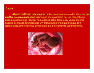 Causa 
Aborto realizado pela mesma, antes do aparecimento dos sintomas,de 
um Ser do sexo masculino,aderido ao seu organismo por um magnetismo 
poderosíssimo,o que resultou na presença sobre todo o seu ventre de uma 
espécie de massa gelatinosa,de um grená quase preto,que pulsava com 
regularidade,com veios que penetravam para o interior de seu organismo. 
 