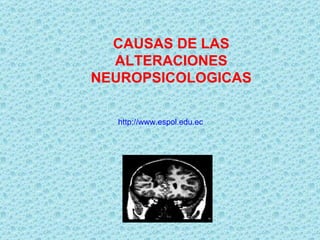 CAUSAS DE LAS ALTERACIONES NEUROPSICOLOGICAS http://www.espol.edu.ec 