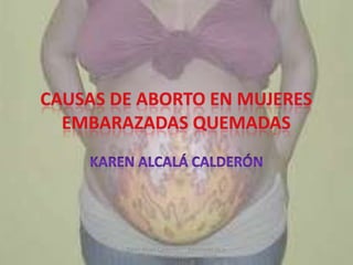 Karen Alcalá Calderón    Estudiante de la
    Facultad de Medicina       BUAP
 