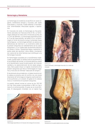 18
Buenas prácticas para la industria de la carne
La hemorragia se evidencia al sacrificio en varios ór-
ganos, membranas serosas y mucosas, piel, tejido
subcutáneo y muscular. Puede deberse a traumatis-
mos, enfermedades infecciosas agudas o septice-
mia.
En músculos de cerdo, la hemorragia es frecuente-
mente asociada con fracturas (Foto 8.16). La hemo-
rragia petequial se nota como minúsculos puntos de
1-2 mm de diámetro. La hemorragia equimótica (Foto
8.17) es de mayor tamaño, de hasta 2-3 cm. La hemo-
rragia en forma de brocha incluye numerosas líneas
hemorrágicas. La hemorragia también se asocia con
deficiencias de vitamina C, un incremento súbito de
la presión sanguínea con debilitamiento de los vasos
sanguíneos, y a un inadecuado aturdimiento eléctrico
en cerdos y ovinos. Transportes largos, exposición a
estrés antes del sacrificio, clima cálido y excitación
son varios de los otros factores que contribuyen a la
hemorragia muscular.
En hemorragias causadas por un aturdimiento inade-
cuado, puede haber un retraso entre el aturdimiento y
el acuchillado del animal. La corriente eléctrica usada
en el aturdimiento causa la estimulación del músculo
cardíaco y la vasoconstricción de los vasos sanguí-
neos. Esto puede inducir un rápido incremento en la
presión sanguínea que lleva a hemorragias en órga-
nos y músculos (es llamada “salpicado de sangre”).
El aturdimiento de animales por un golpe mecánico en
la cabeza se practica aún en ovinos y es una causa
importante de hemorragia en órganos, particularmen-
te los pulmones y el corazón. El golpe en la cabeza
inicia un incremento en la presión sanguínea.
La presión arterial normal en ovinos es de 120-145
mm Hg. Esta puede incrementarse a 260 mm Hg o
más en un animal aturdido. El pulso se ve incrermen-
tado. El desangrado inmediato con el rápido flujo
Hemorragia y Hematoma	
FOTO 8.16
Hueso fracturado y hemorragia muscular en un cerdo de
mercado.
FOTO 8.17
Hemorragia equimótica en el músculo de la lengua de una vaca.
FOTO 8.18
Hematoma en la pared abdominal de una oveja.
D.HERENDA,CANADAD.HERENDA,CANADA
D.HERENDA,CANADA
 