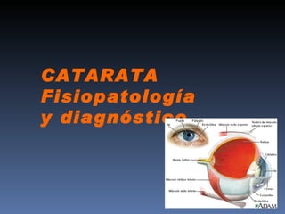 CATARATA
Fisiopatología
y diagnóstico
 