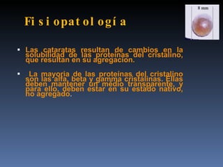 Fi s i opat ol o gí a

 Las cataratas resultan de cambios en la
    solubilidad de las proteínas del cristalino,
    que resultan en su agregacion.
    La mayoria de las proteínas del cristalino
    son las alfa, beta y gamma cristalinas. Ellas
    deben mantener un médio transparente, y
    para ello, deben estar en su estado nativo,
    no agregado.
 