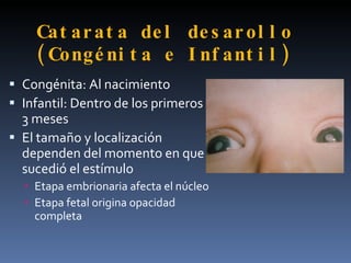 Cat ar at a de l de s ar ol l o
    ( Congé ni t a e I nf ant i l )
 Congénita: Al nacimiento
 Infantil: Dentro de los primeros
  3 meses
 El tamaño y localización
  dependen del momento en que
  sucedió el estímulo
   Etapa embrionaria afecta el núcleo
   Etapa fetal origina opacidad
    completa
 