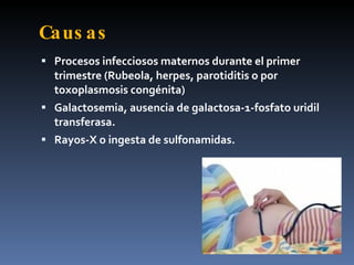 Caus as
 Procesos infecciosos maternos durante el primer
  trimestre (Rubeola, herpes, parotiditis o por
  toxoplasmosis congénita)
 Galactosemia, ausencia de galactosa-1-fosfato uridil
  transferasa.
 Rayos-X o ingesta de sulfonamidas.
 