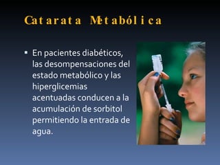 Cat ar at a M t aból i c a
             e

 En pacientes diabéticos,
  las desompensaciones del
  estado metabólico y las
  hiperglicemias
  acentuadas conducen a la
  acumulación de sorbitol
  permitiendo la entrada de
  agua.
 