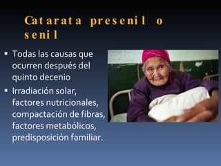 Cat ar at a pr e s e ni l o
     s e ni l
 Todas las causas que
  ocurren después del
  quinto decenio
 Irradiación solar,
  factores nutricionales,
  compactación de fibras,
  factores metabólicos,
  predisposición familiar.
 