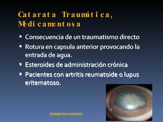 Cat ar at a Tr a um t i c a ,
                   á
M di c am nt o s a
 e        e
 Consecuencia de un traumatismo directo
 Rotura en capsula anterior provocando la
    entrada de agua.
   Esteroides de administración crónica
   Pacientes con artritis reumatoide o lupus
    eritematoso.



            TRAUMATICA O ROSETA
 