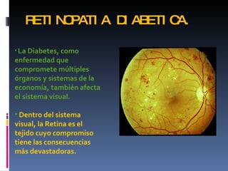RETI N PATI A D AB
         O        I  ETI CA.

• La Diabetes, como
enfermedad que
compromete múltiples
órganos y sistemas de la
economía, también afecta
el sistema visual.

• Dentro del sistema
visual, la Retina es el
tejido cuyo compromiso
tiene las consecuencias
más devastadoras.
 