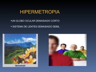 HIPERMETROPIA
UN GLOBO OCULAR DEMASIADO CORTO

 SISTEMA DE LENTES DEMASIADO DEBIL
 