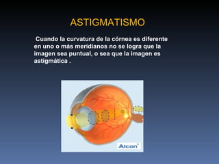 ASTIGMATISMO
 Cuando la curvatura de la córnea es diferente
en uno o más meridianos no se logra que la
imagen sea puntual, o sea que la imagen es
astigmática .
 