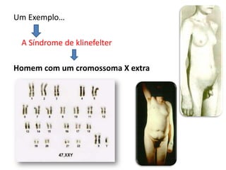 Um Exemplo…

 A Síndrome de klinefelter

Homem com um cromossoma X extra
 