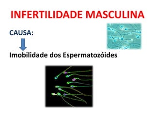 INFERTILIDADE MASCULINA
CAUSA:

Imobilidade dos Espermatozóides
 