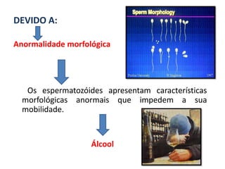 DEVIDO A:

Anormalidade morfológica




   Os espermatozóides apresentam características
  morfológicas anormais que impedem a sua
  mobilidade.


                   Álcool
 