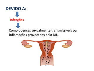 DEVIDO A:

 Infecções

 Como doenças sexualmente transmissíveis ou
 inflamações provocadas pelo DIU.
 