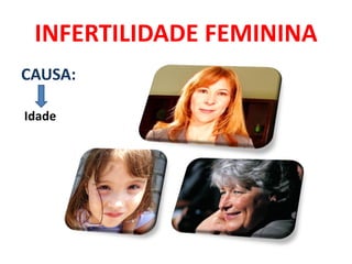INFERTILIDADE FEMININA
CAUSA:

Idade
 