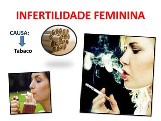 INFERTILIDADE FEMININA
CAUSA:

 Tabaco
 