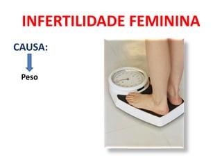 INFERTILIDADE FEMININA
CAUSA:

 Peso
 