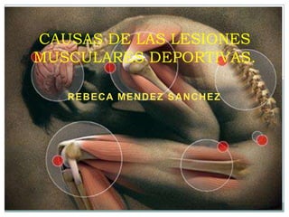 CAUSAS DE LAS LESIONES
MUSCULARES DEPORTIVAS.
REBECA MENDEZ SANCHEZ

 
