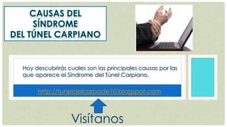 Hoy descubrirás cuales son las principales causas por las
que aparece el Síndrome del Túnel Carpiano.
http://tuneldelcarpode10.blogspot.com
Visítanos
 