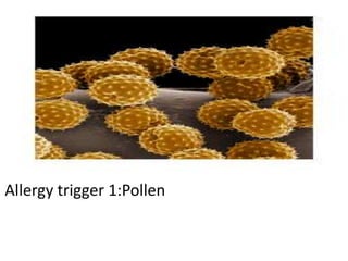 Allergy trigger 1:Pollen 
 