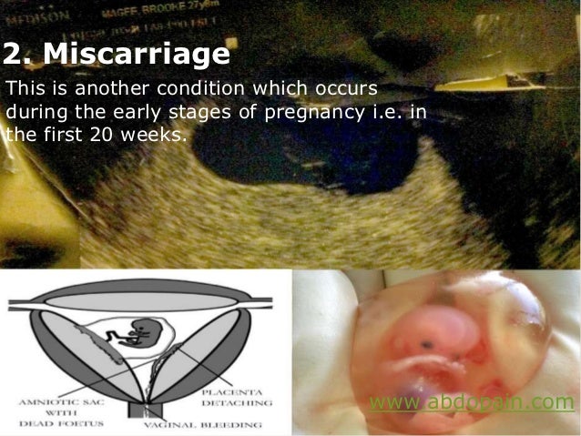 Cause abdominal pain during pregnancy