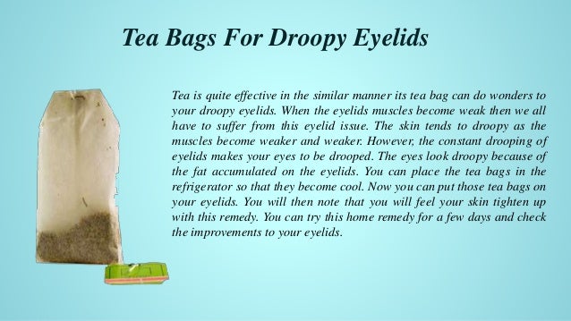 home remedies for sore eyelids