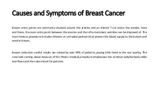 Causes and Symptoms of Breast Cancer
Bosom entry points are commonly situated around the areolas and an altered T cut under the areolas. Here
and there, the even entry point between the areolas and the infra mammary wrinkles can be disposed of. The
most famous procedure includes inferiors or unrivaled pedicels that protect the blood supply to the bosom and
areolar tissues.
Bosom reduction careful results are valued by over 90% of patients, paying little heed to the scar quality. The
new look coming about because of this Plastic medical procedure emphasizes the common ladylike body ebbs
and flows and the solace level for patients.
 