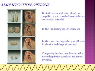 Causes and Treatment of Hearing Loss | PDF