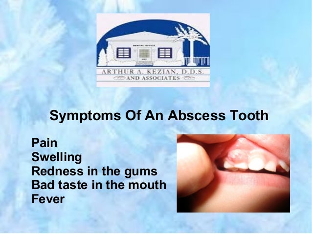 Can Gum Abscess Cause Fever? | Signs of Tooth Abscess: Stages and ...