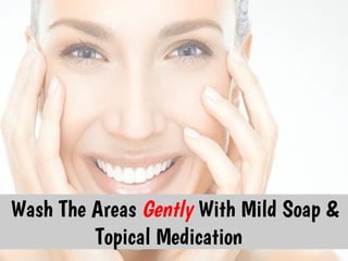 Wash The Areas Gently With Mild Soap &
         Topical Medication
 
