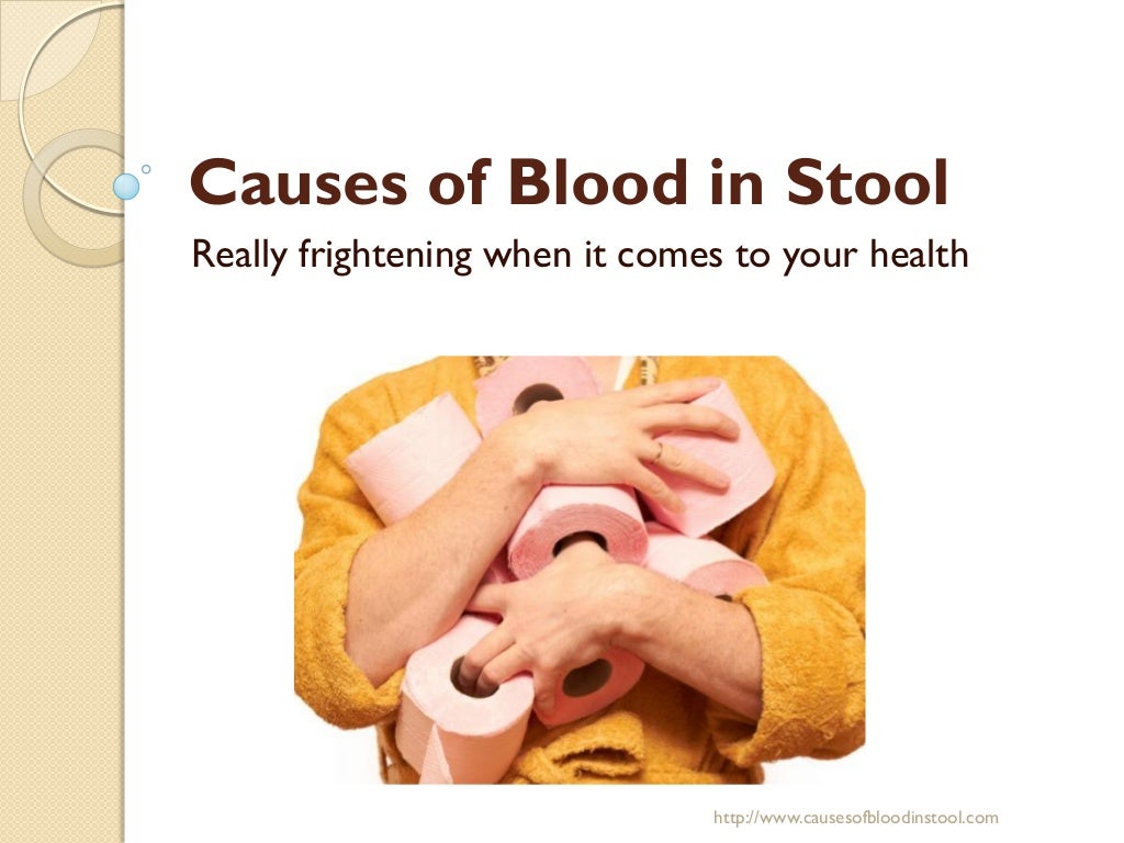 Causes of blood in stool