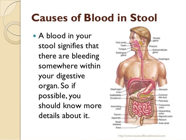 What is the treatment for bleeding in the stool?
