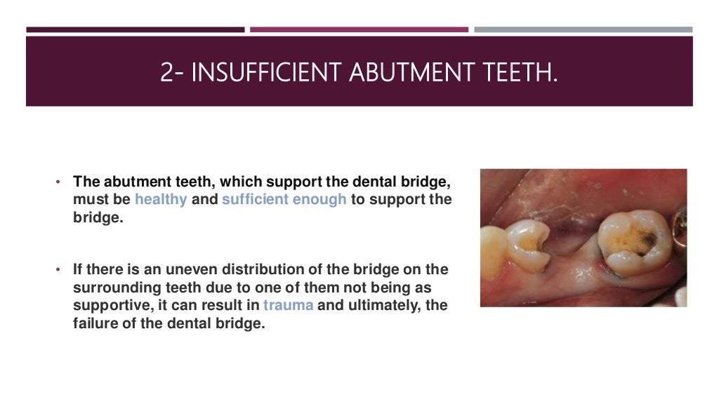 Causes of Bridge Failure SS.pptx