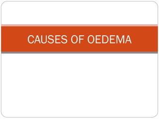 CAUSES OF OEDEMA
 