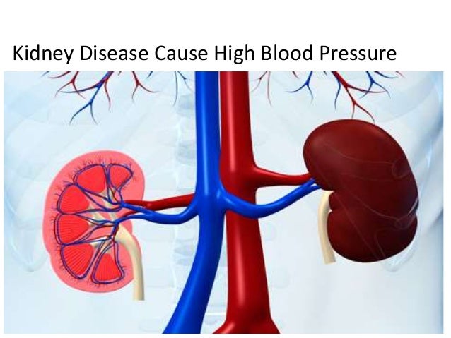 causes of high blood pressure diet