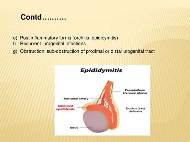 Causes of infertility