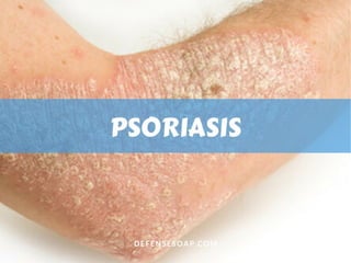 Causes Of Itchy Skin | PPT