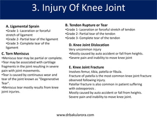 www.drbakularora.com
3. Injury Of Knee Joint
A. Ligamental Sprain
•Grade 1- Laceration or forceful
stretch of ligament
•Grade 2- Partial tear of the ligament
•Grade 3- Complete tear of the
ligament
B. Tendon Rupture or Tear
•Grade 1- Laceration or forceful stretch of tendon
•Grade 2- Partial tear of the tendon
•Grade 3- Complete tear of the tendon
C. Torn Meniscus
•Meniscus tear may be partial or complete.
•Tear may be associated with cartilage
fragments in the joint resulting in severe
pain with joint movements.
•Tear is caused by continuous wear and
tear of the joint known as "Degenerative
Tear".
•Meniscus tear mostly results from knee
joint injuries.
D. Knee Joint Dislocation
Very uncommon injury
•Mostly caused by auto accident or fall from heights.
•Severe pain and inability to move knee joint
E. Knee Joint Fracture
Involves femur, tibia, patella or fibula.
Fracture of patella is the most common knee joint fracture
observed following injury.
Patellar fracture is also common in patient suffering
with osteoporosis .
Mostly caused by auto accident or fall from heights.
Severe pain and inability to move knee joint.
 