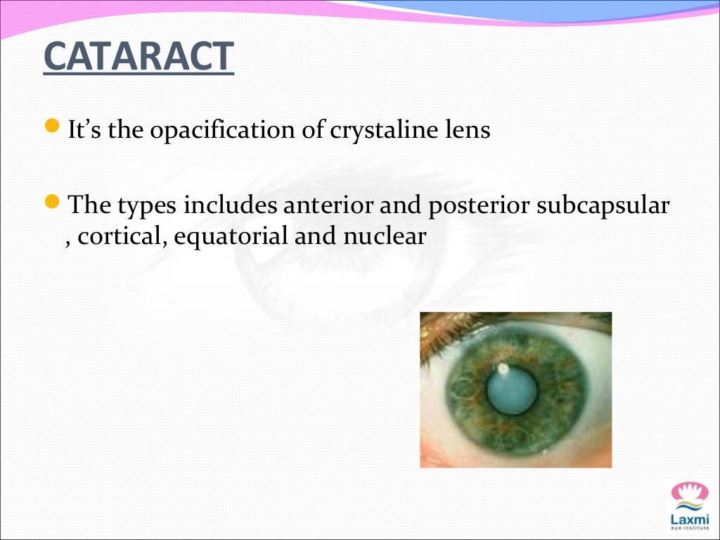 Causes of low vision in adult