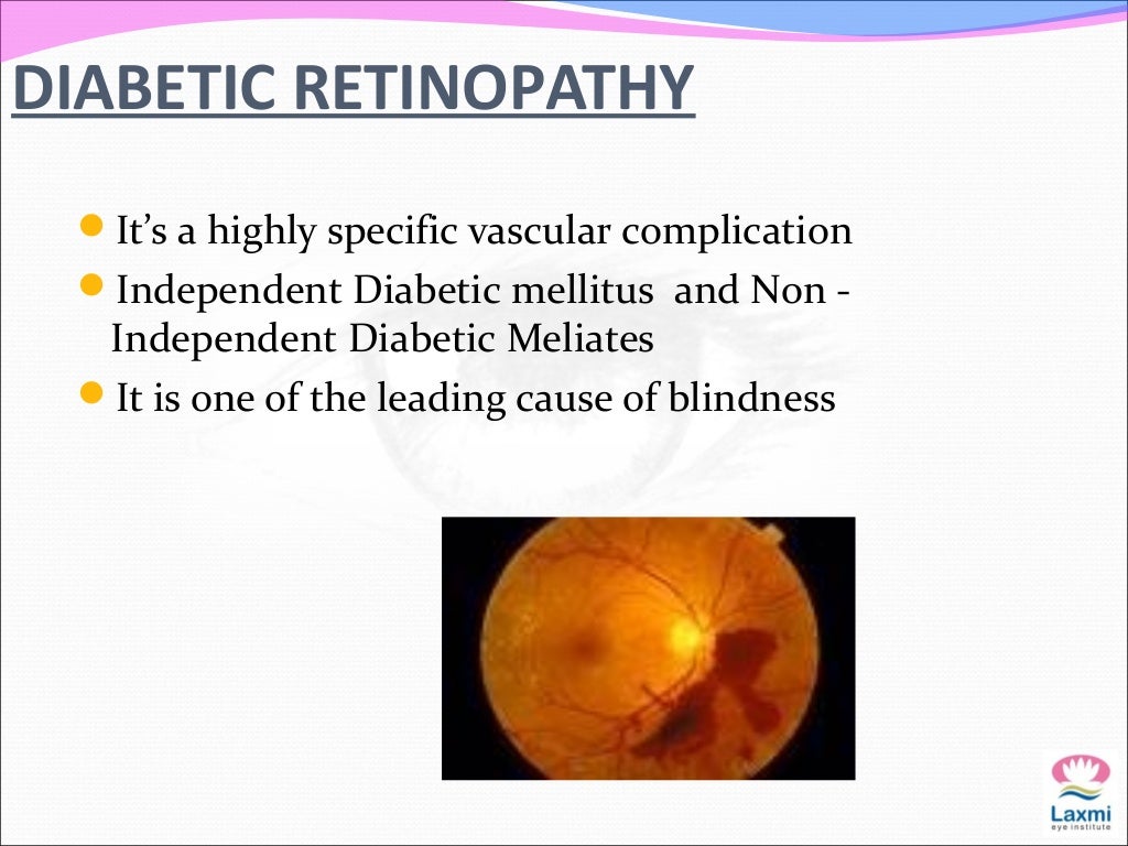 Causes of low vision in adult