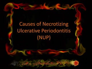 Causes of Necrotizing Ulcerative Periodontitis(NUP) 
